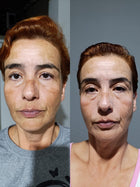 Resultado cliente 2