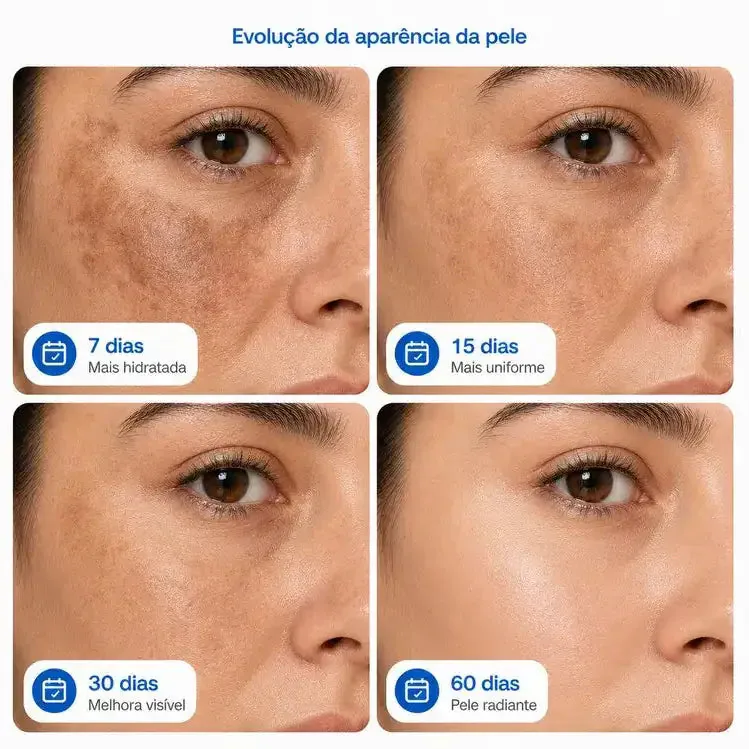 Evolução do tom da pele com 7, 15, 30 e 60 dias de Face Clean