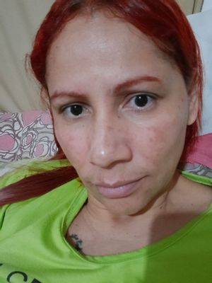 Sandrinha antes